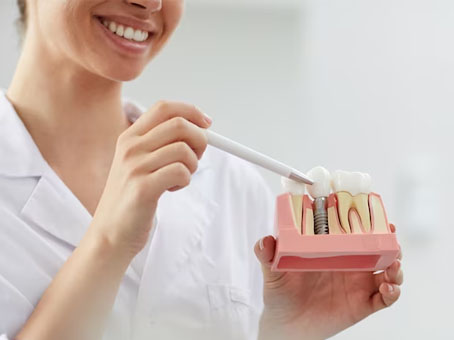 Diş İmplantı İle İlgili Bilinmesi Gerekenler