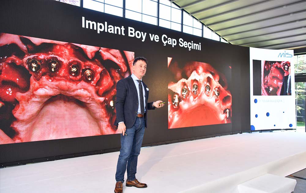 en iyi implant diş doktoru Rehberi