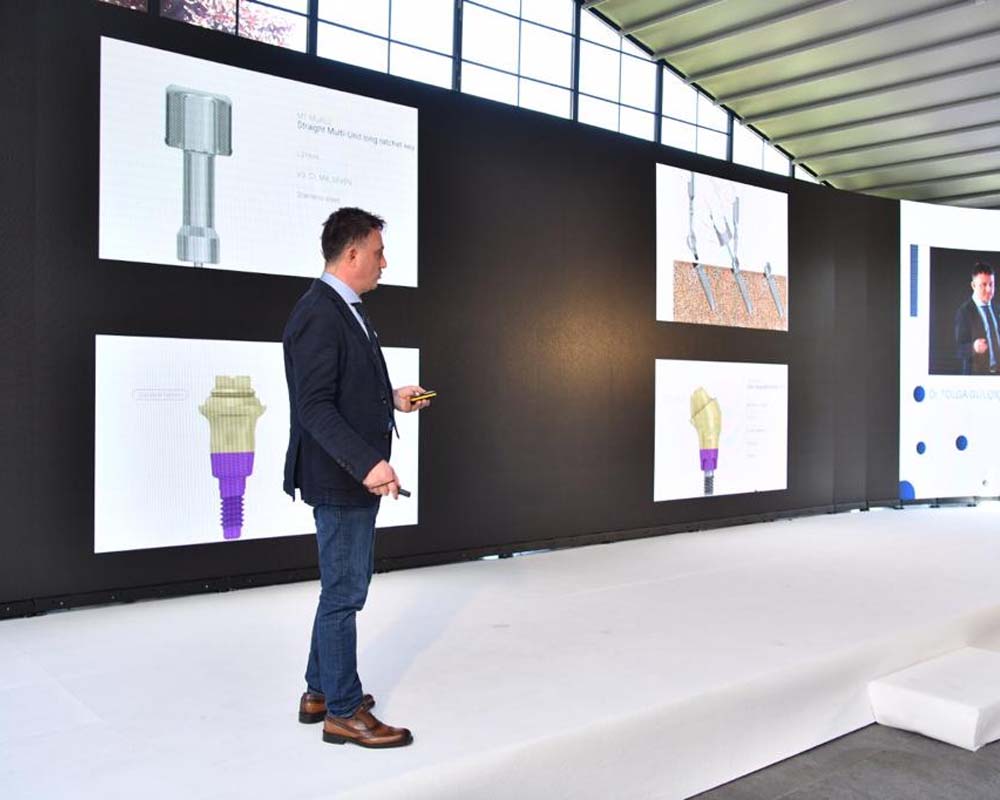 İmplant Fiyatları neye göre değişir ? İstanbul da implant fiyatları